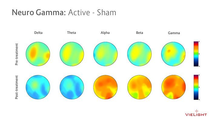vielight neuro gamma EEG map