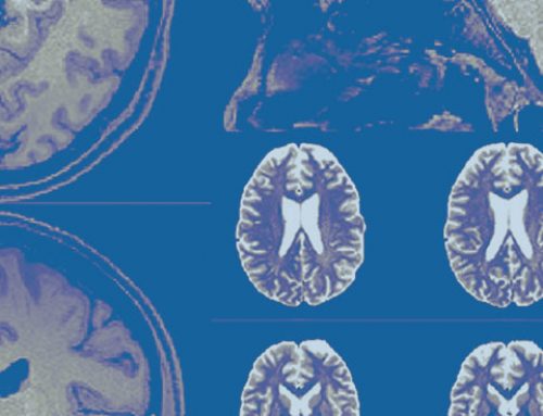 Case Study: Vielight Neuro Helps Regrowing Human Brain Cells