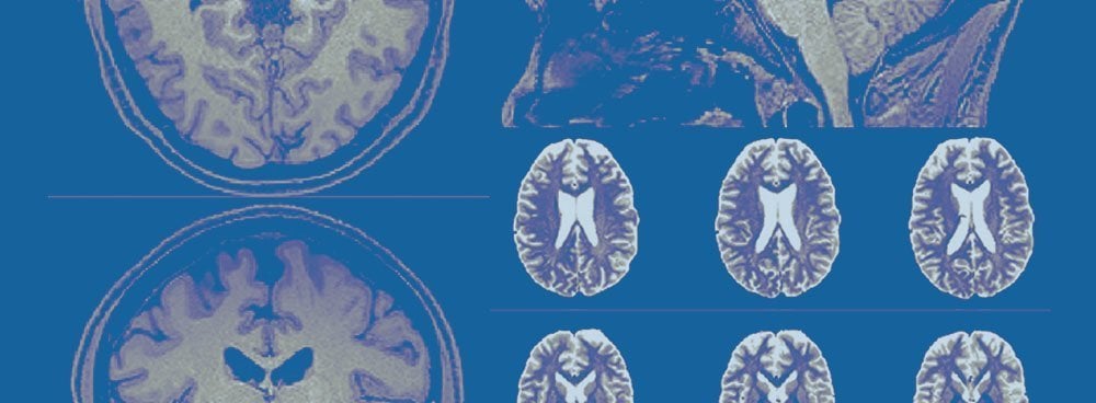 regrowing human brain cells