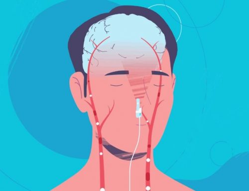 What is Intranasal Systemic Photobiomodulation?