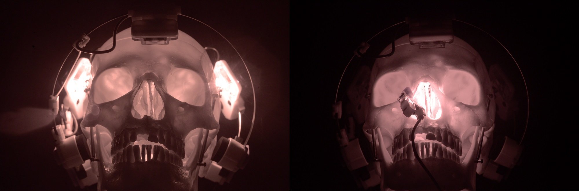 photobiomodulation brain
